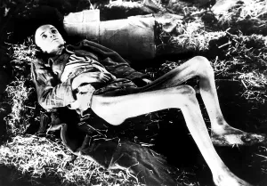 Starvation Prints: A victim of a German concentration camp