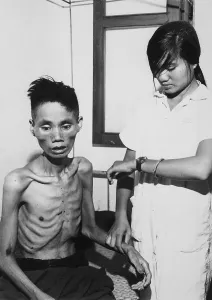 Proxy Wars Prints: Victim of Viet Cong starvation