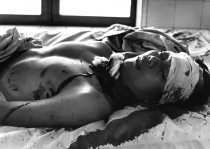 Republic Of Vietnam Prints: Vietnam War. One of 48 persons wounded by a Viet Cong explosion which killed 14 persons in Saigon awaits treatment
