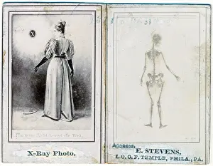 Bones Prints: Two views of a woman, clothed, and as an X-ray