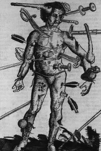 Patients Prints: WOUND MAN. A man with wounds from many different kinds of weapons from a field manual for military surgeons